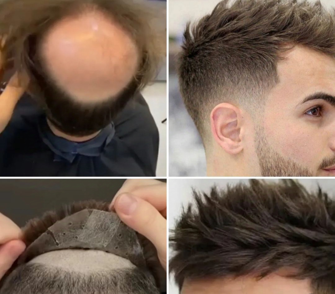 foto-pelucas